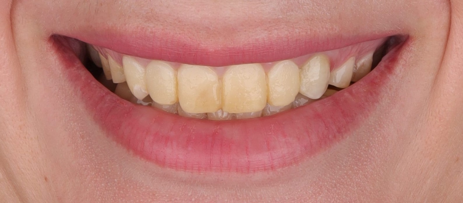 best cosmetic dentistry best dentist in egypt in the best dental clinic